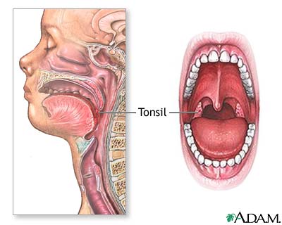 tonsil